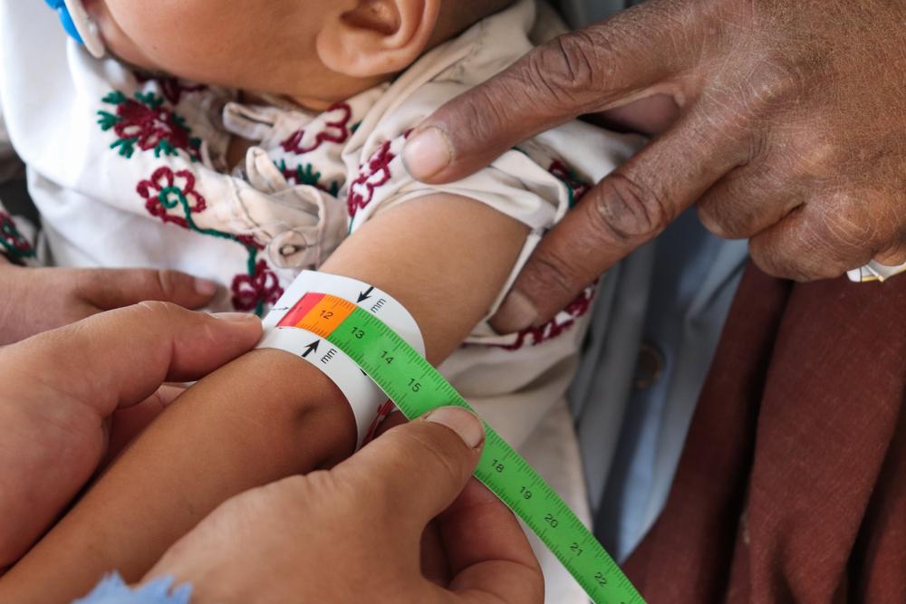 ©Tasal Khogyani/MSF - Kandahar Ambulatory Therapeutic Feeding Centre