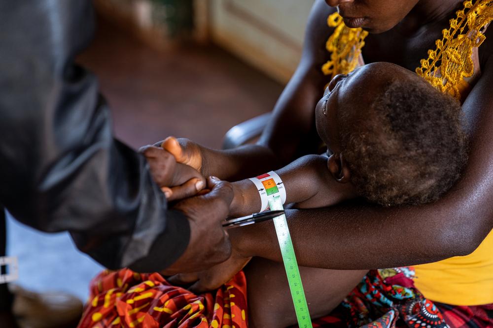 Un enfant est soumis à un diagnostic de malnutrition par un agent de santé communautaire à Cuvango, dans la province de Huila, en Angola