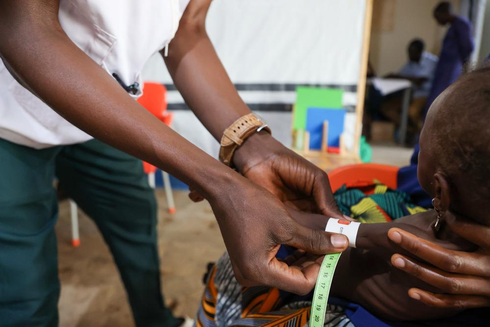 Le triage est une étape cruciale dans l'accueil et le transfert des enfants malnourris.