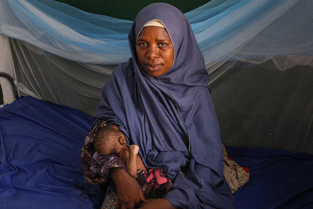 Nigeria : Un enfant sur quatre souffre de malnutrition à  Shinkafi et Zurmi