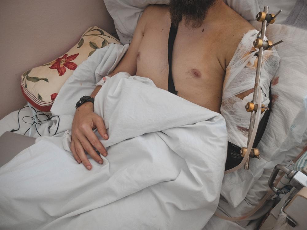 Arturs, patient MSF de 30 ans, gravement blessé au bras.