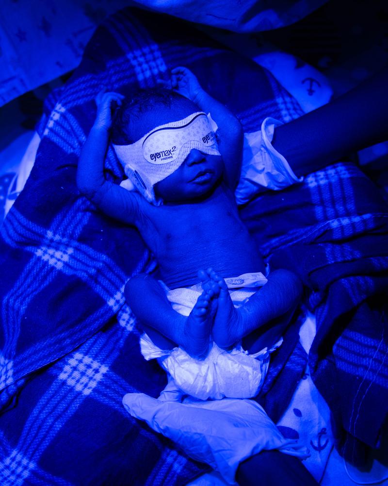 Dans l'unité de soins intensifs néonatals du centre Kushari CEMONC à Maiduguri, les bébés atteints d'ictère sont placés sous des lampes UV pendant de courtes périodes.