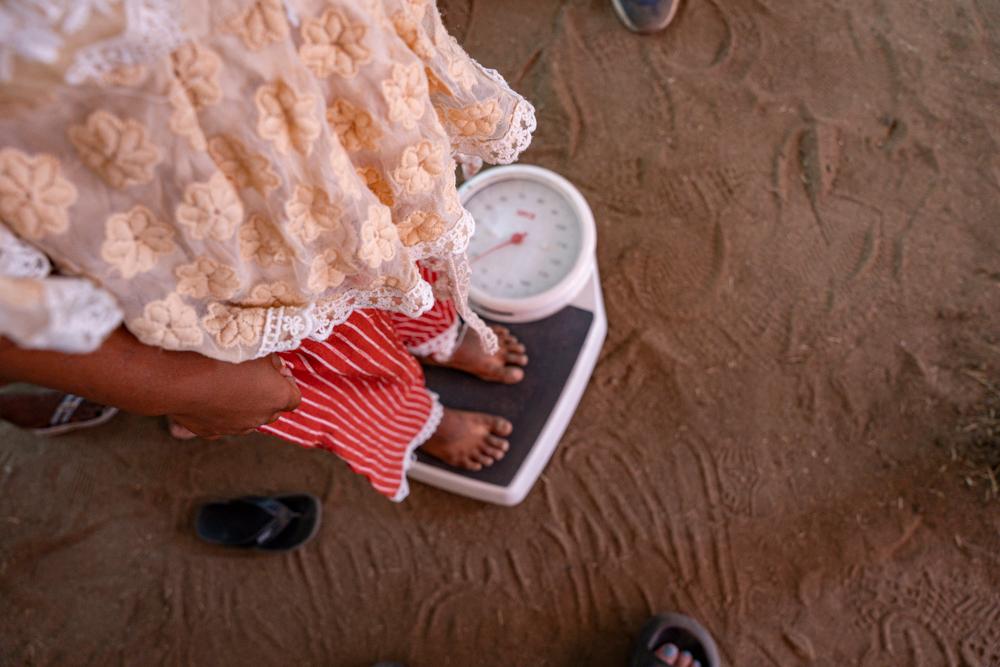 Dans une clinique mobile MSF à Girbanat, un enfant en triage est pesé, dans le cadre du protocole de triage de chaque patient avant de procéder à la consultation.