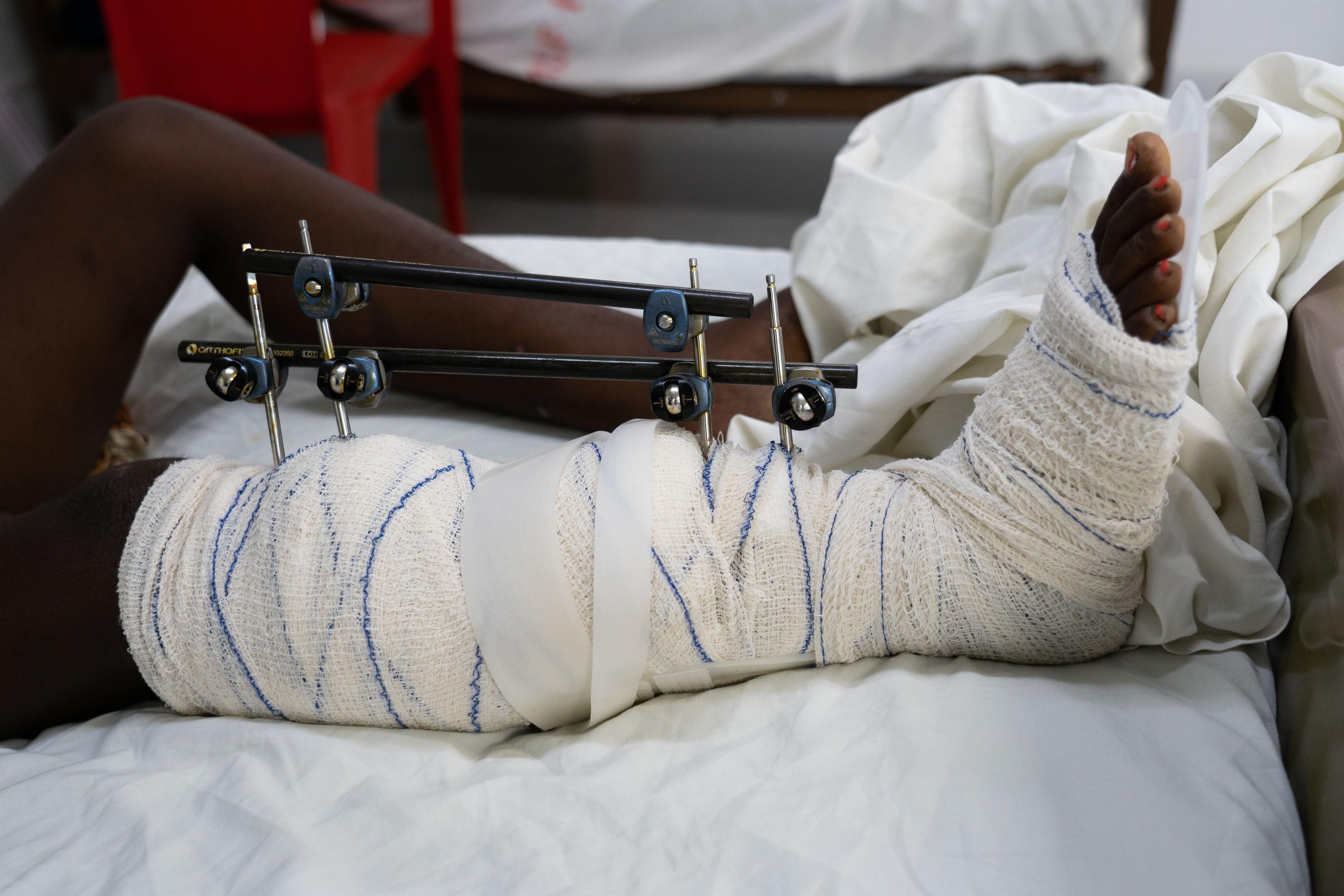 Femmes hospitalisées à l'hôpital MSF de Tabarre, Port-au-Prince, pendant la vague de violence qui a balayé la capitale haïtienne en février et mars 2024.