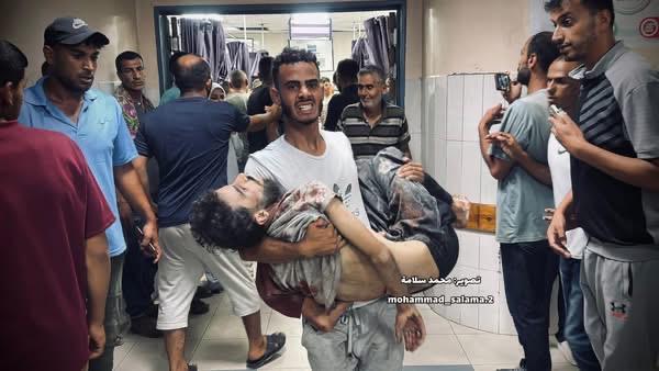 Abdullah Hammad, ancien collègue de MSF, est transporté à l'hôpital Nasser suite à l'attaque ciblée des forces israéliennes contre des personnes qui tentaient de récupérer de la nourriture dans des camions de distribution, le 3 juillet. Gaza, juillet 2025 © Mohammad Salama