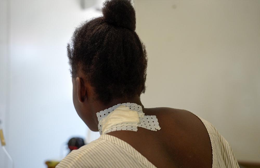 Linda, 21 ans, a été touchée par une balle perdue alors qu'elle se trouvait à l'église. Le tir provenait de membres d'un groupe armé qui avaient ouvert le feu sur un hélicoptère de la police à quelques rues de là. Haïti. Janvier 2026  © Marx Stanley Léveillé/MSF