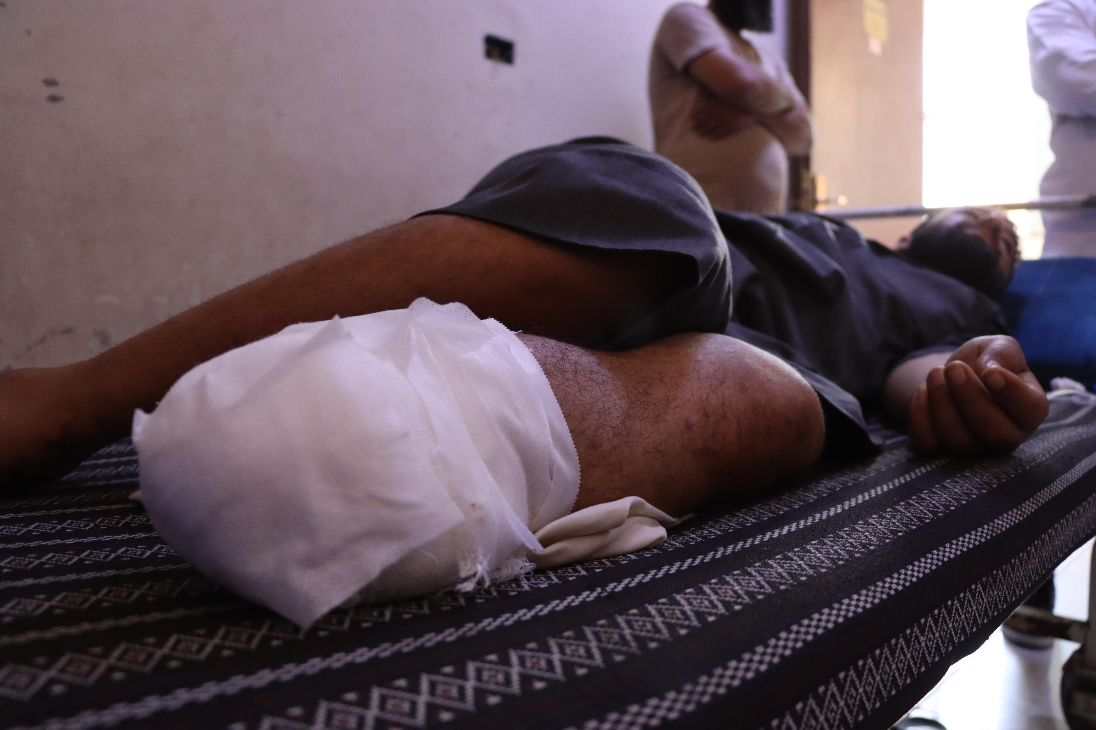 Ali, âgé de 28 ans, a été blessé après avoir marché sur une mine terrestre enfouie à la périphérie de la ville de Subaykhan, le 12 mai 2025 à 18 h, ce qui a entraîné l'amputation de sa jambe gauche. Deir Ez-Zor, Syrie. Juin  2025 © Asmar Al-Bahir/MSF 