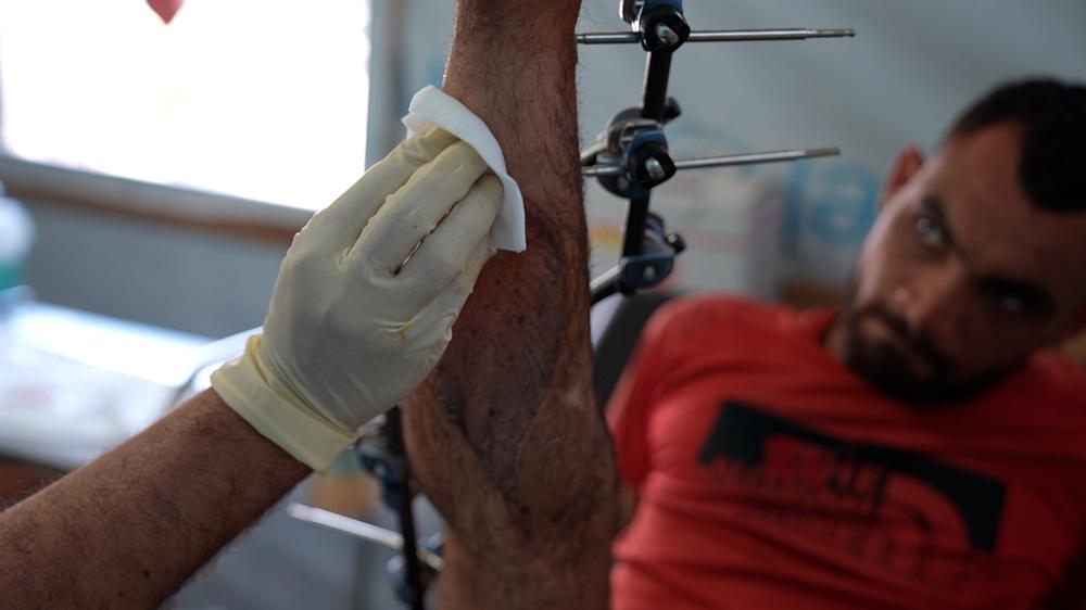 Un membre du personnel de MSF examine la blessure de Saad Hussein, contraint de vivre avec un fixateur externe depuis qu'il a été blessé en 2025 lors d'une distribution alimentaire organisée par la Fondation humanitaire de Gaza. Centre de soins de santé primaires Al Mawasi, Khan Younis, Gaza. Mai, 2026 © Nour Alsaqqa/MSF 