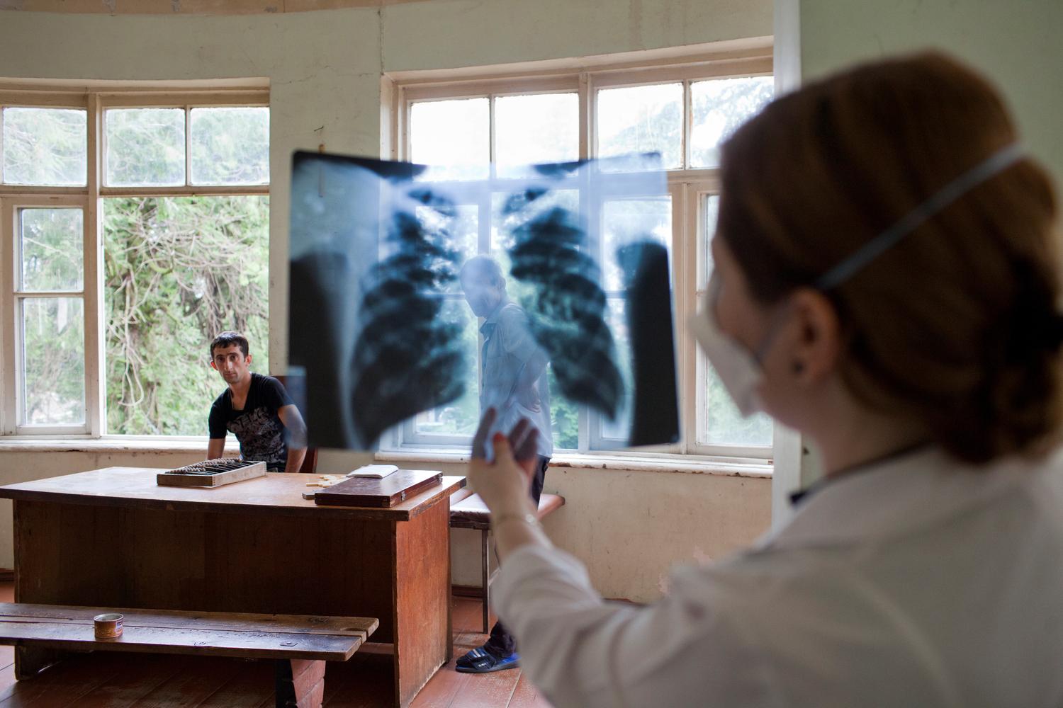 Une médecin spécialiste de la tuberculose, au Centre régional de pathologie infectieuse, du sida et de la tuberculose de Batumi, où MSF a commencé à travailler en 2014. Géorgie. Juillet 2016. 