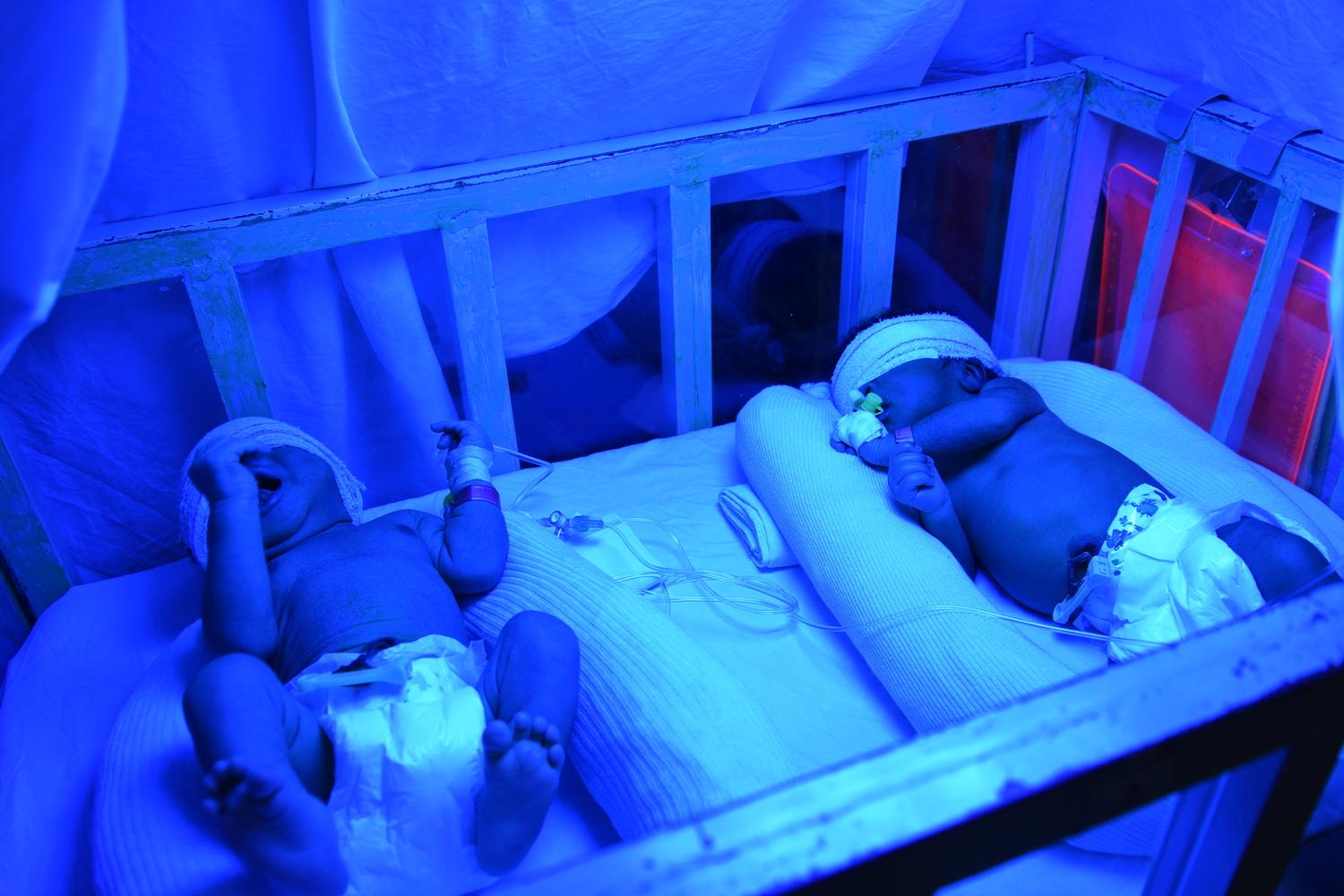  Deux nouveau-nés atteints de jaunisse sont traités par photothérapie à l&#039;hôpital de Katiola, dans la région du Hambol. Côte d&#039;Ivoire. Mars 2017. 