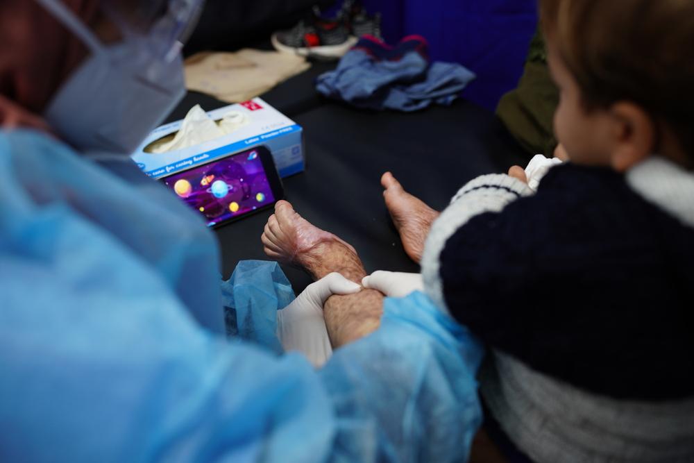 An MSF physical therapist Reem Abu Lebdeh does a scar massage to Adballah. Ten months ago, Abdallah had a scalding burn that damaged 50 percent of his total body surface. 