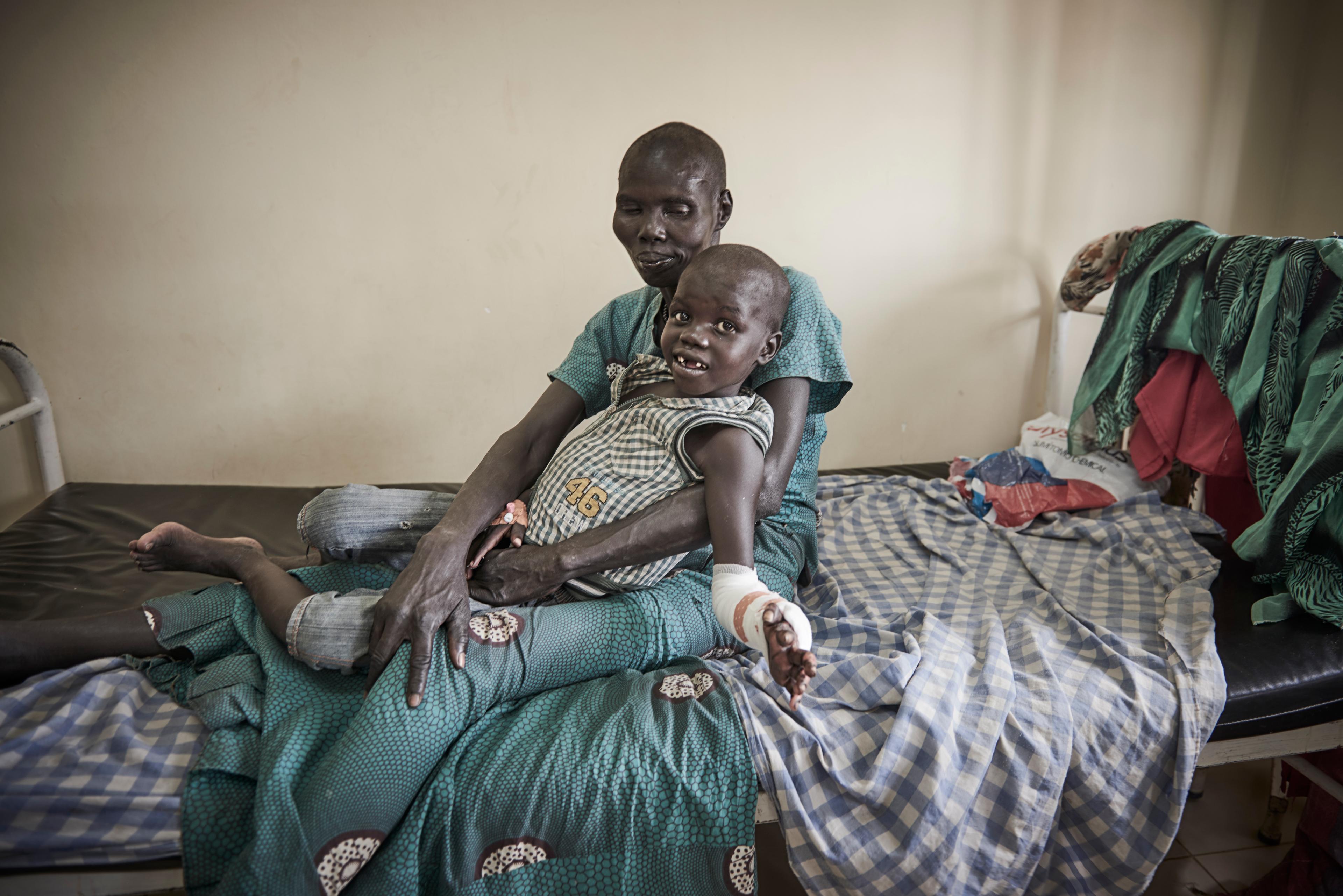 Hoth Kuol Juol, 7 ans, a contracté le paludisme à l&#039;âge de 2 ans. Il a subi des lésions cérébrales - Hoth ne reconnaît plus sa famille et souffre de crises fréquentes. 