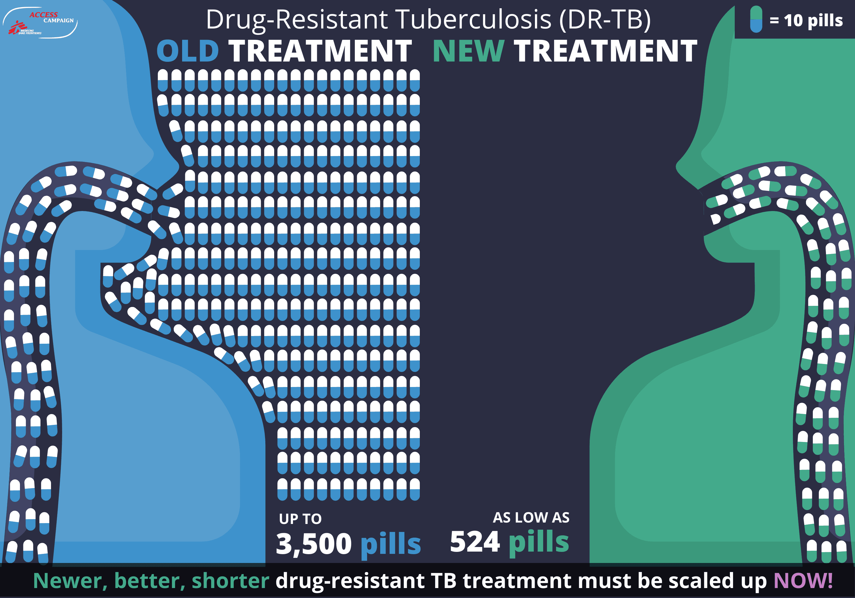 Graphiques produits par la Campagne d&#039;accès sont destinés à être utilisés pour toutes les communications liées à la tuberculose en octobre 2022. 