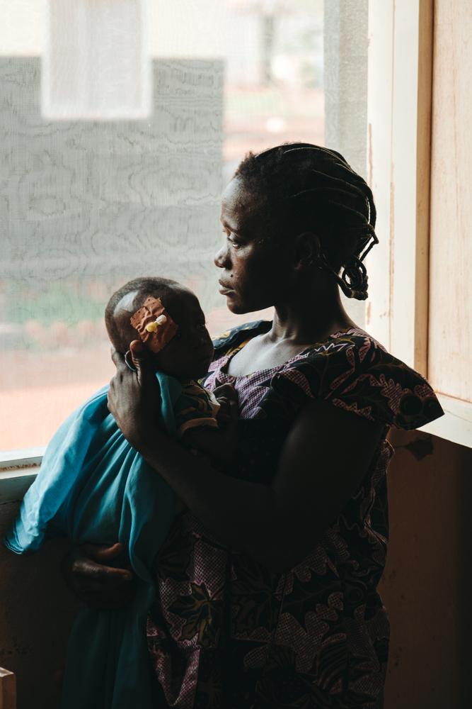 Annie Guemba and her baby, admitted for the third time for acute malnutrition at the Bangassou regional university hospital. 