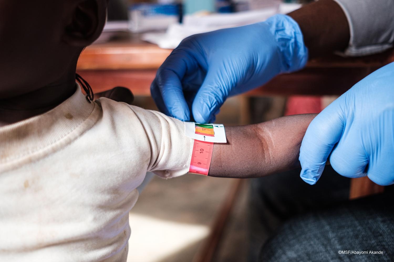 Un enfant est en train de se faire dépister pour la malnutrition par les équipes MSF. Nigéria. Octobre 2020. 