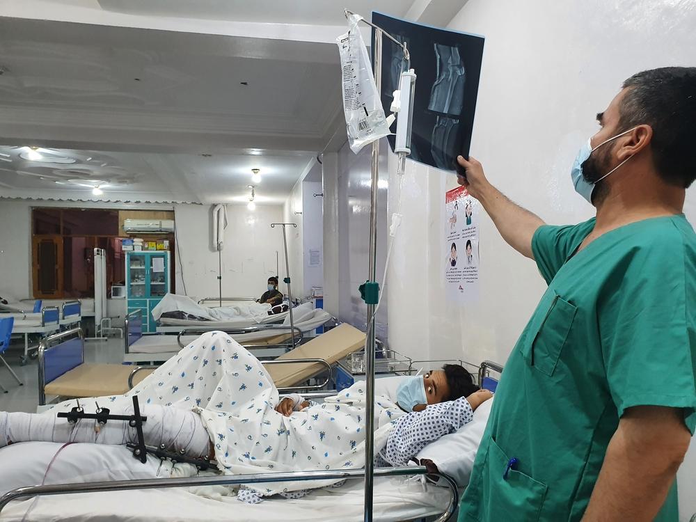 Salle des urgences de l'unité de traumatologie d'urgence de MSF à Kunduz, un infirmier examine la radiographie d'un patient qui a subi une fracture compliquée de la partie supérieure et inférieure de sa jambe suite à l'explosion d'une bombe. Juillet 2021 