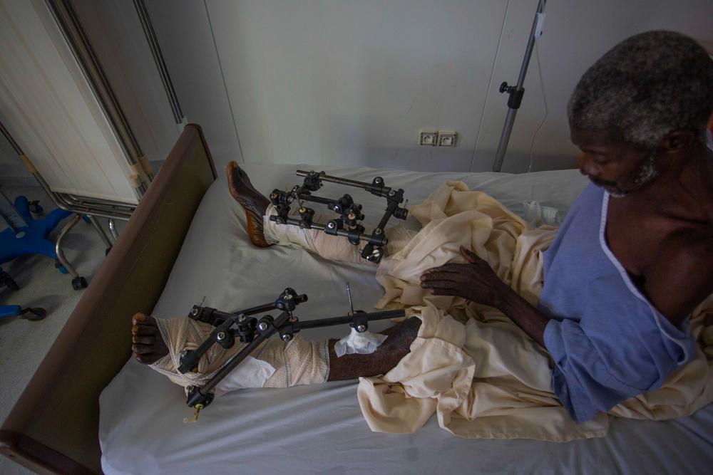 A victim of the 14 August earthquake is treated at the Tabarre hospital after being referred by the South region, the worst affected area in Haiti 