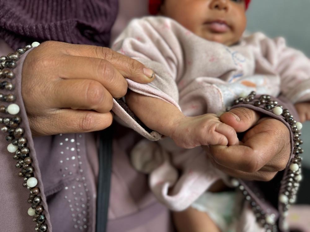 Une mère palestinienne montre l'état de la peau de son petit enfant au centre de santé primaire d'Attar où MSF fournit des soins de santé primaires essentiels à la population palestinienne de Khanyounis.