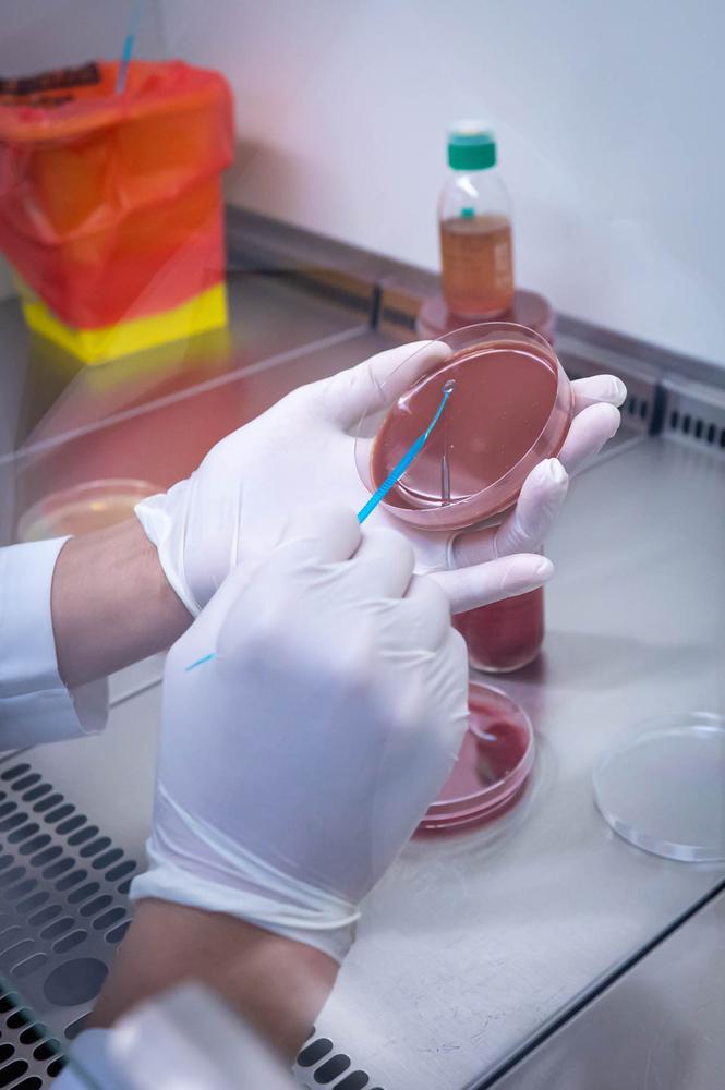 Manual culture-based analysis of a blood sample     