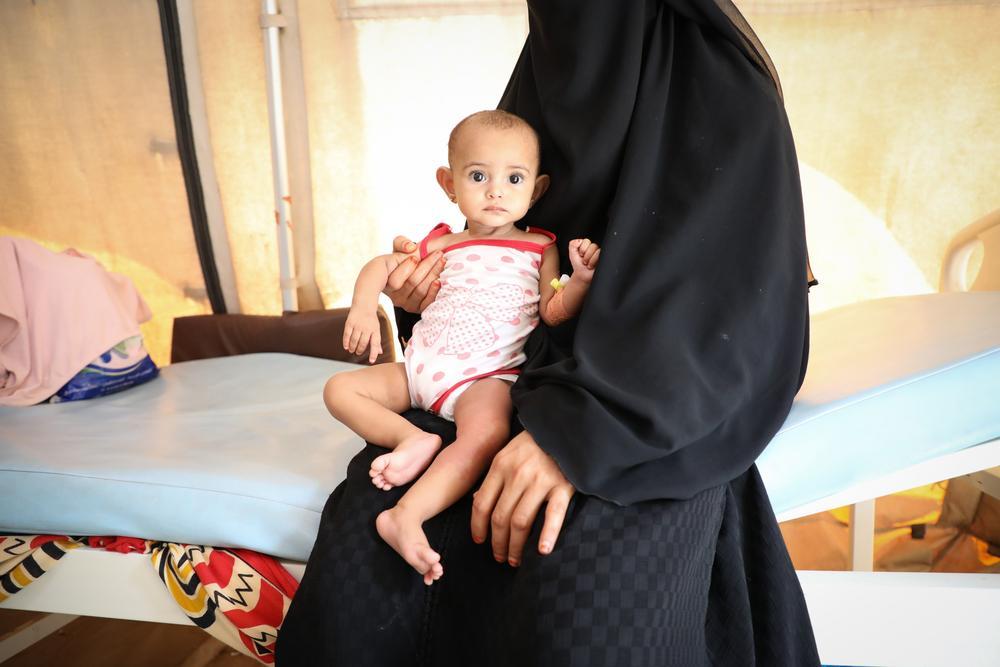 Cinq raisons pour lesquelles la malnutrition infantile aigue explose au Yémen 