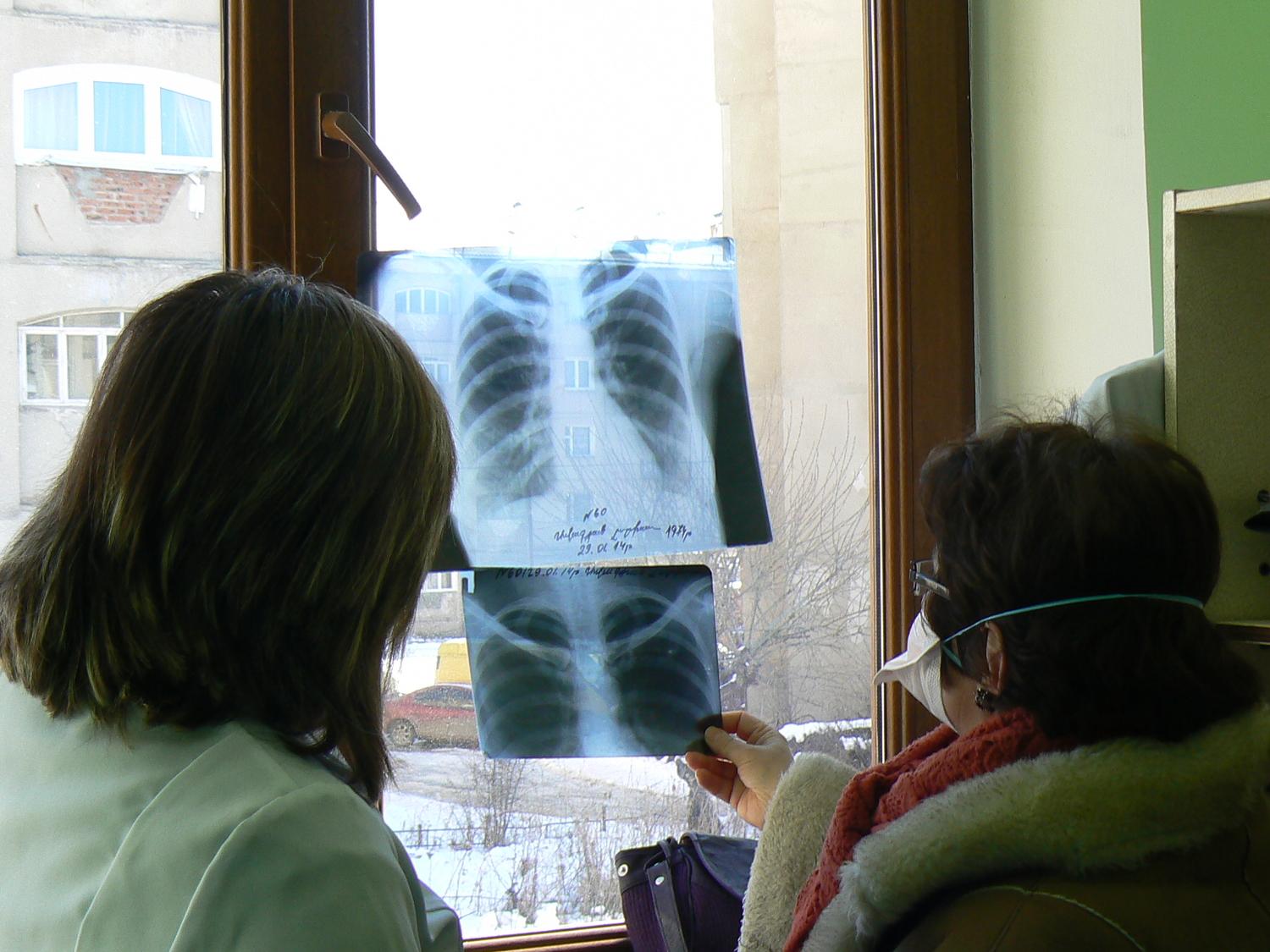 Une des consultantes de MSF à Vanadzor (à droite), et une médecin du ministère de la santé, examinant les radiographies d&#039;un patient atteint d&#039;une tuberculose résistante aux médicaments. Arménie. Février 2014. 