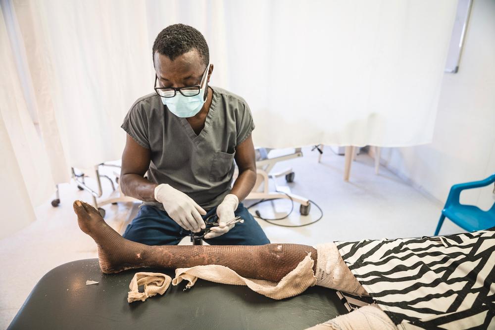 Le personnel de MSF nettoie une greffe de peau pour une patiente qui a subi une brûlure grave à la jambe - Octobre 2021. 