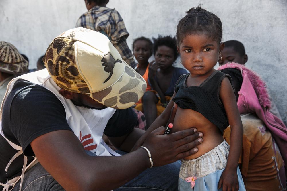 Une infirmière de la clinique mobile de MSF inspecte une petite fille pour sélectionner les cas les plus urgents parmi les bénéficiaires qui attendent d&#039;être vus, dans le village de Befeno, Commune Marovato, le 2 septembre 2021. 