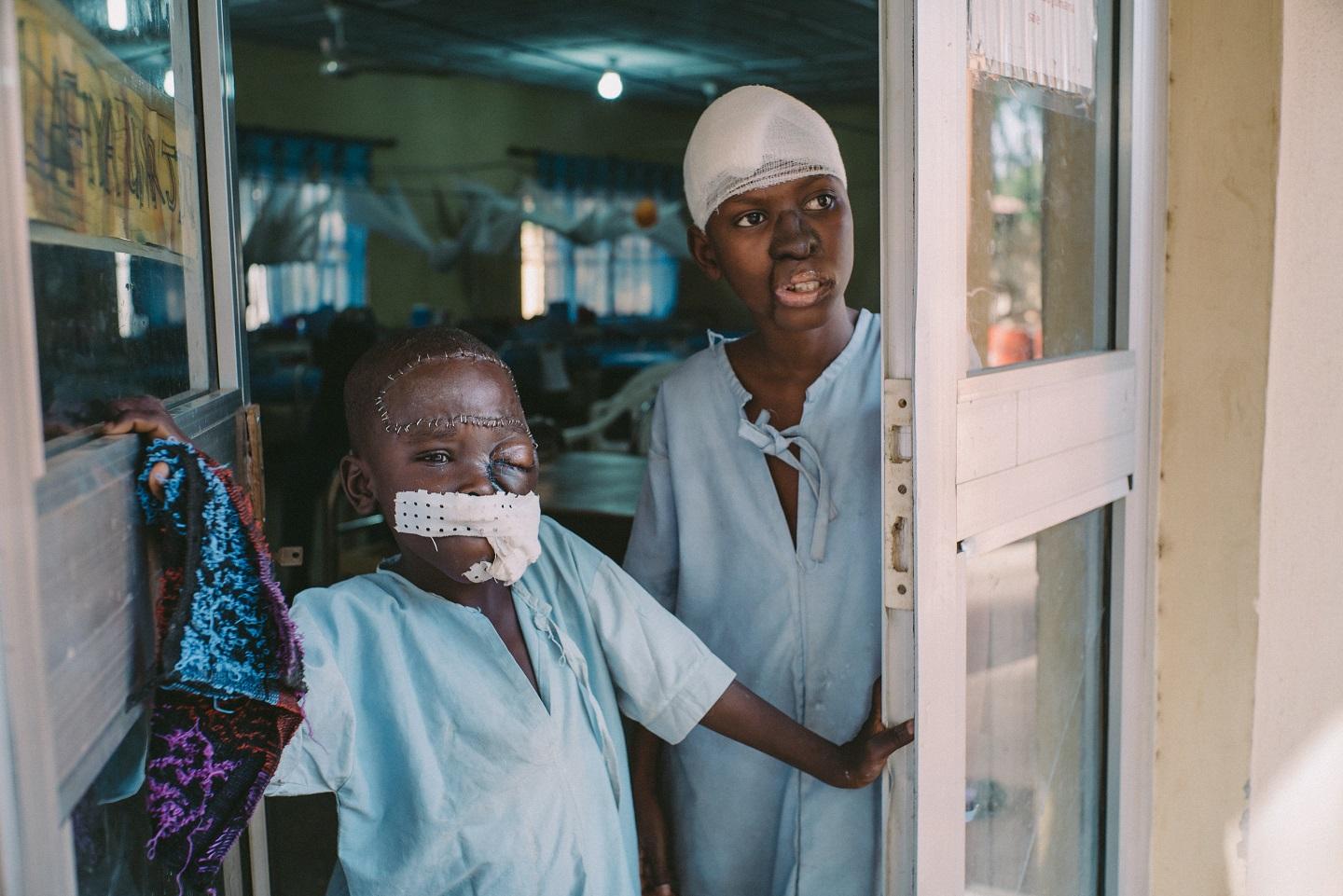 Umar, 8, and Adamu, 15, stand at the entrance of the post-operative ward at the Sokoto Noma Hospital. They recently underwent surgery and are confined to the ward to avoid infections. Nigeria, October 2018. 