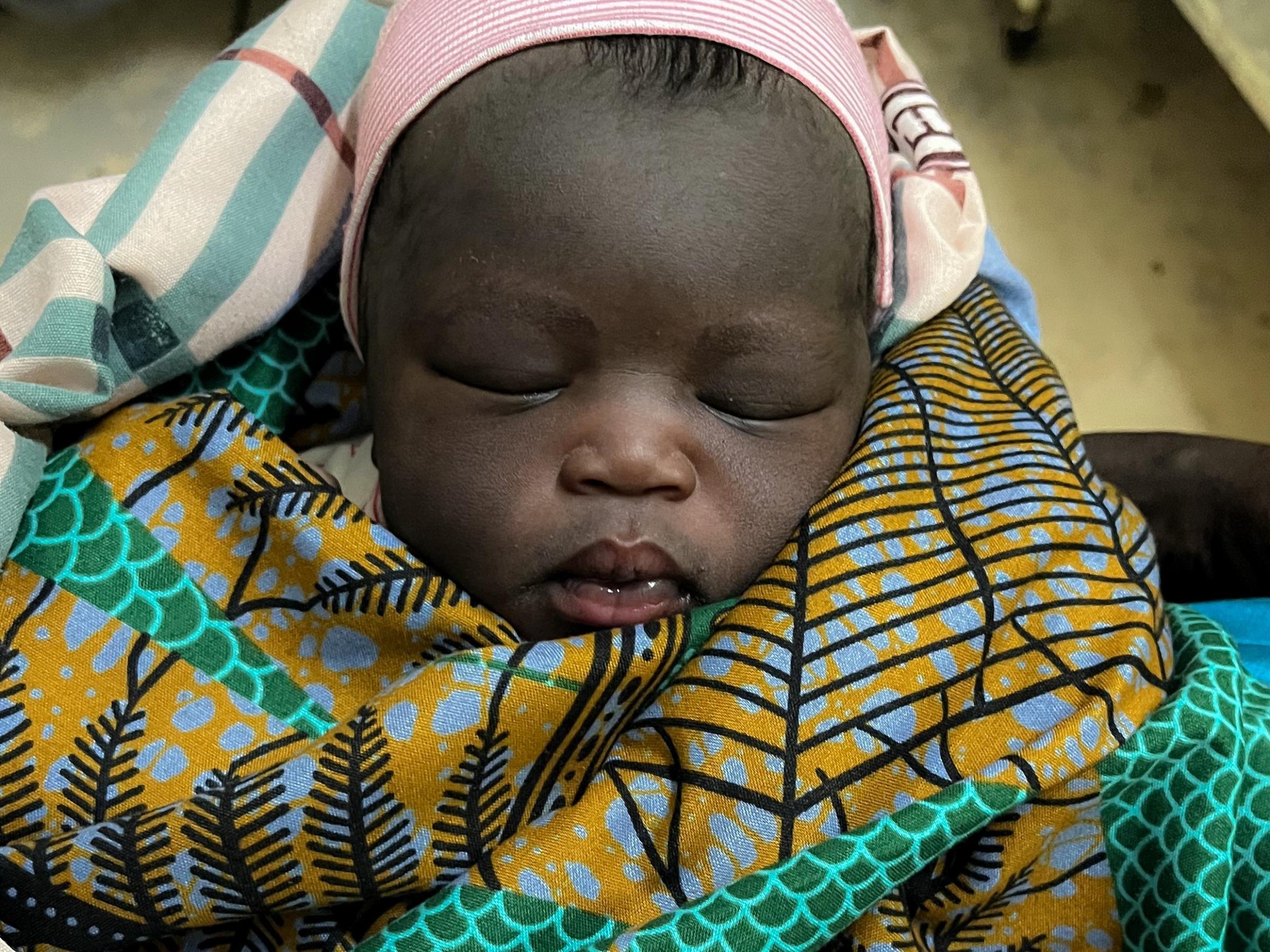 Bébé Nyamuch. Soudan du Sud © MSF