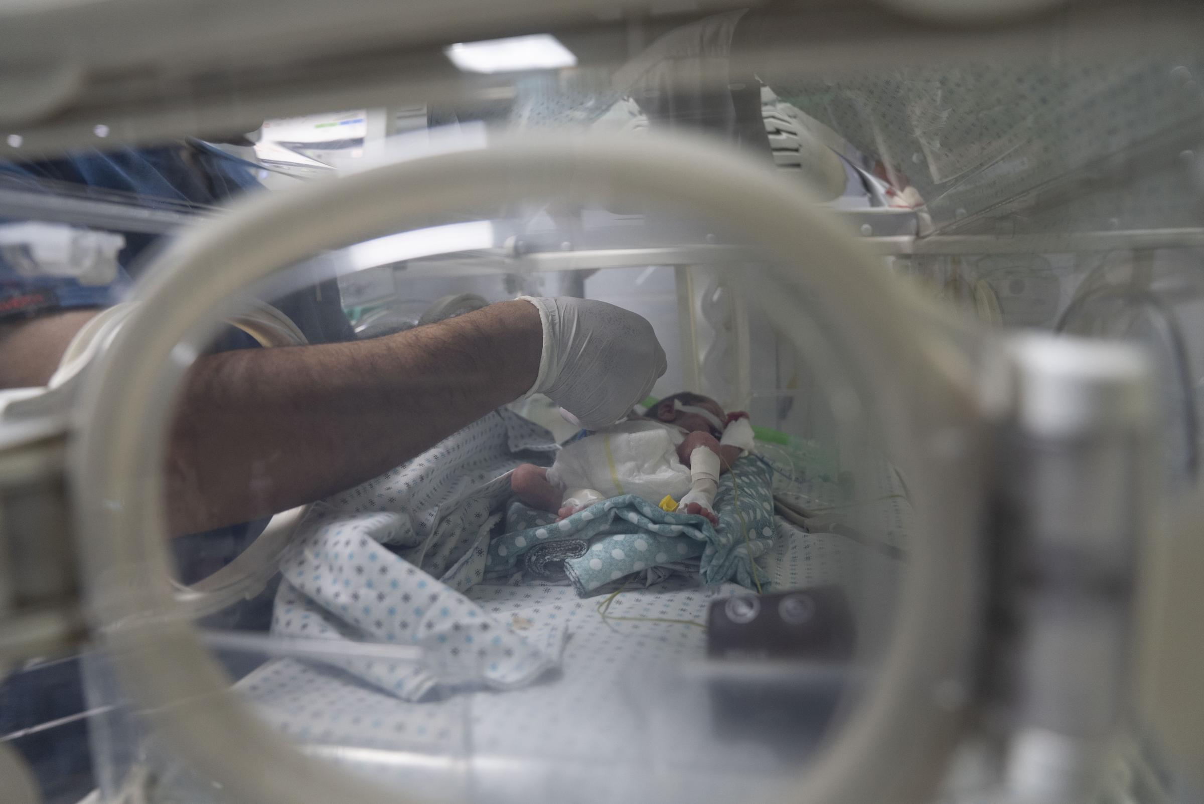 MSF : la restriction délibérée de l'accès à la nourriture et à l'aide humanitaire a entraîné des niveaux alarmants de malnutrition à Gaza
