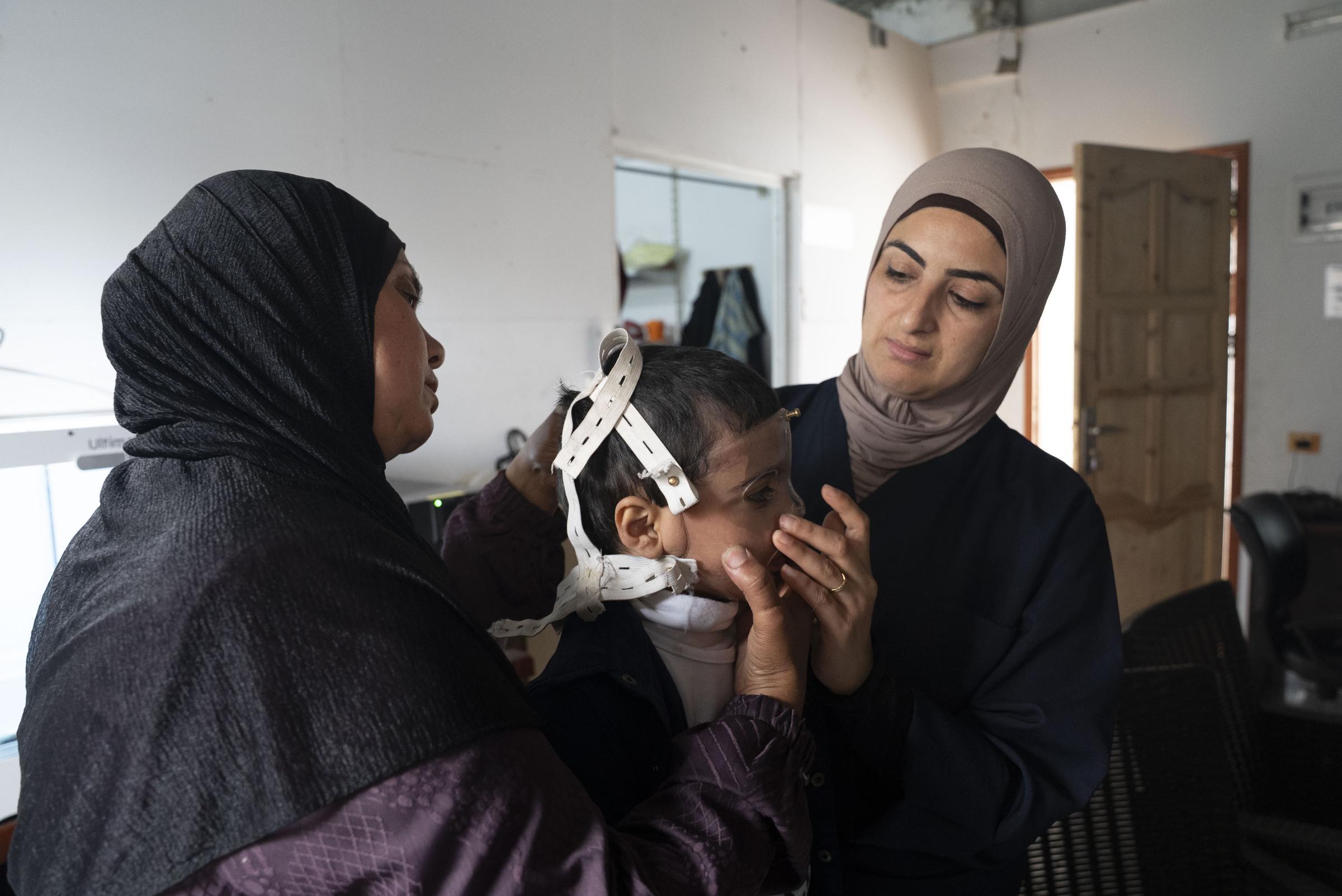 Lors de l’atelier de physiothérapie 3D dans la clinique de MSF à Gaza-ville, Ibtihal, physiothérapeute de MSF, ajuste un masque 3D sur Joud, une patiente brûlée de quatre ans. Palestine, mars 2026. © Nour Alsaqqa/MSF